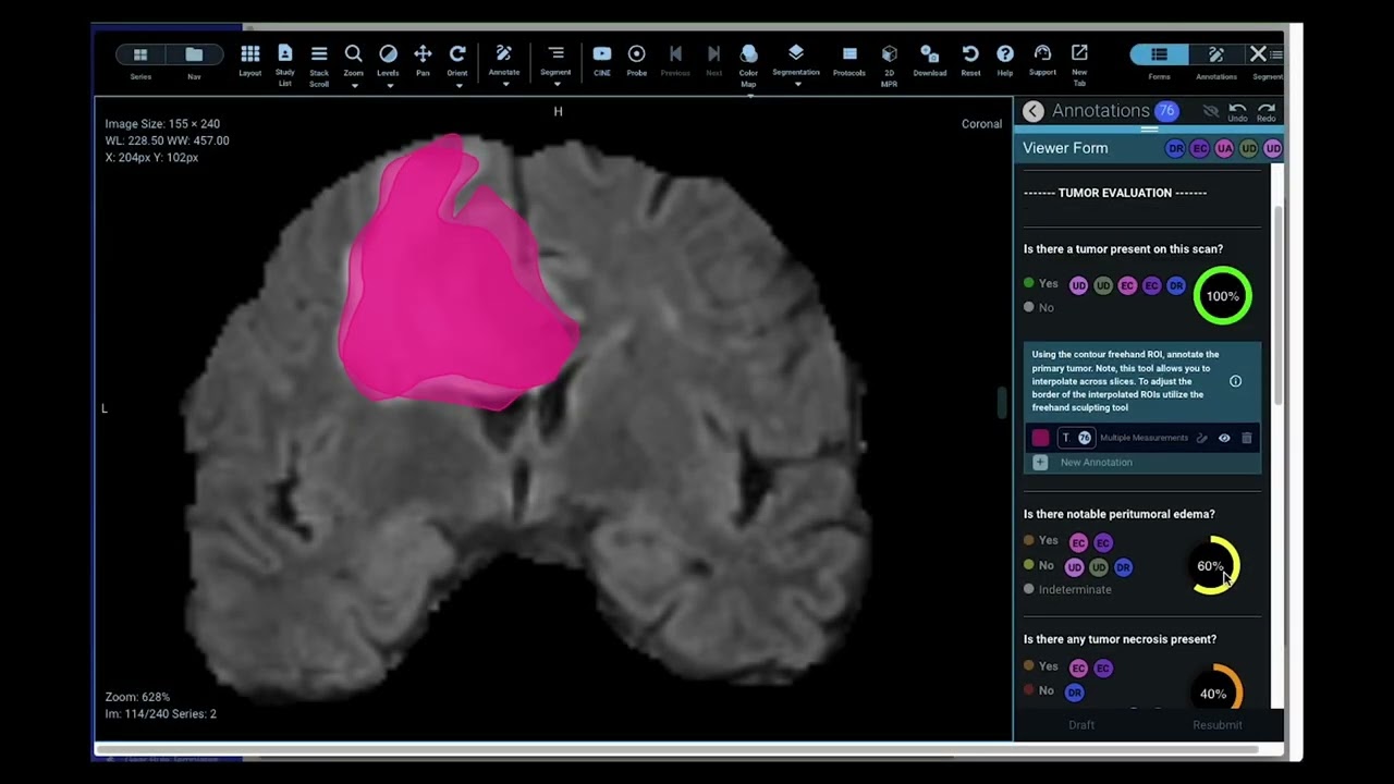 Flywheel for Oncology | Medical Imaging Platform for Data Management