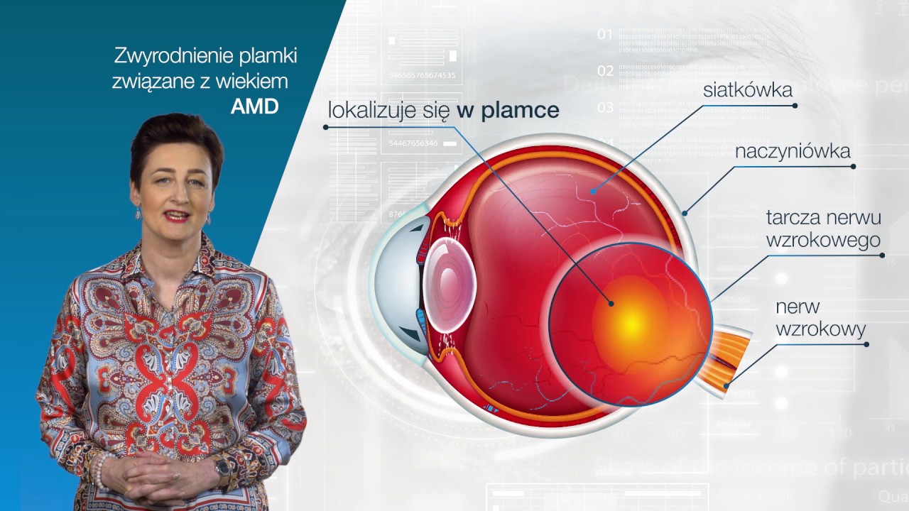 Zwyrodnienie plamki związane z wiekiem (AMD) część 1