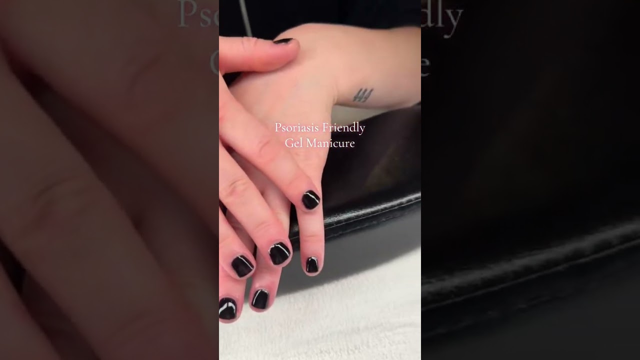 Psoriasis Friendly Manicure #nails #psoriasis #nailcare #naturalnails #nailtech #opi #health