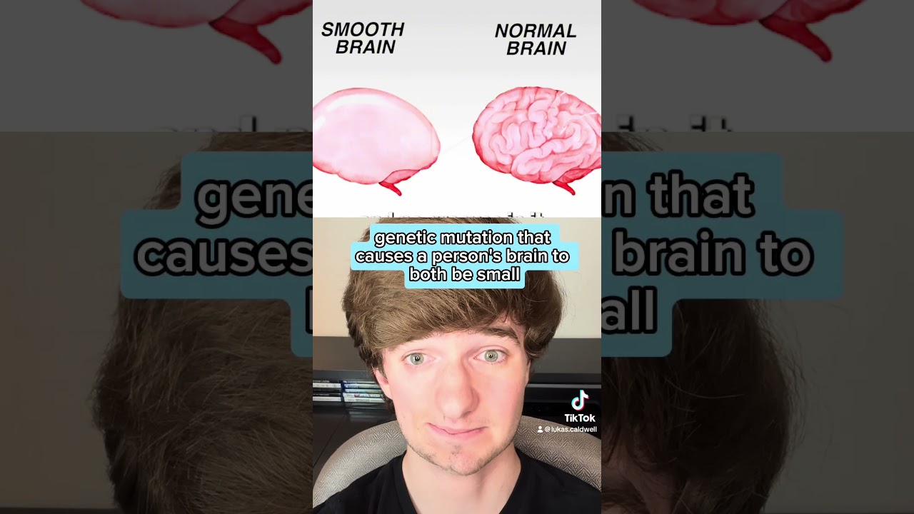 Smooth Brain Syndrome