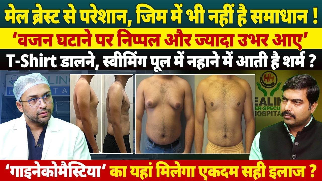 Male Breast Reduction Surgery | Gynecomastia Surgery Best Results | Healing Hospital Chandigarh