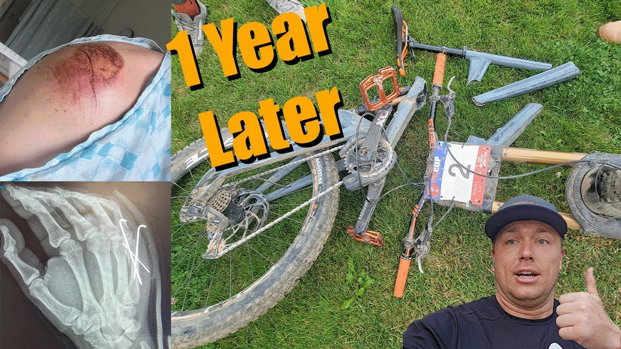 1 Year Later - Frame Implosion