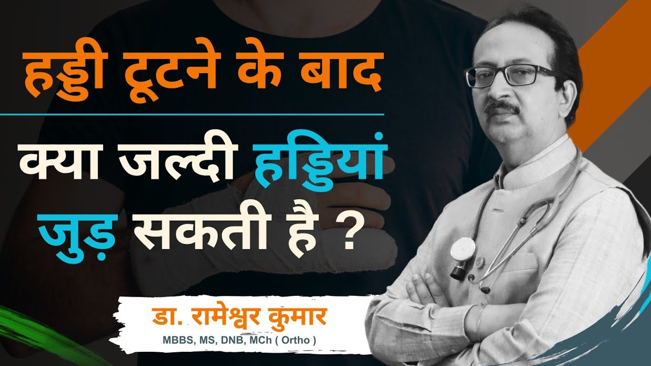 हड्डी टूटने के बाद क्या जल्दी हड्डियां जुड़ सकती है ?  Exercise करना जरूरी या नहीं ? #bonefracture
