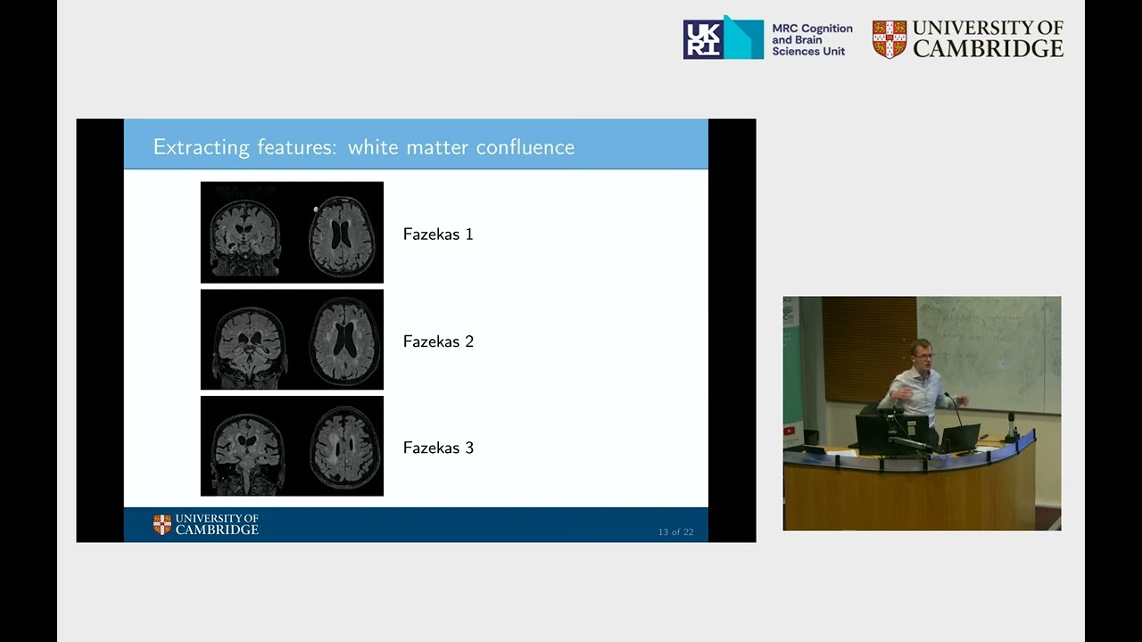Novel approaches to detect abnormalities on MRI in neurodegenerative disorders