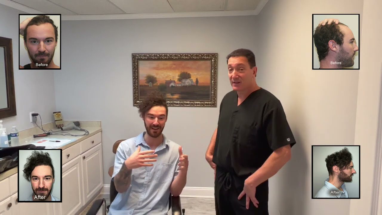 Dr. Brett Bolton Patient Casey FUE Correction