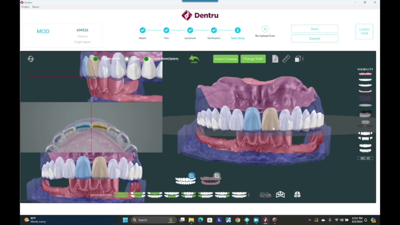 Free Denture design software tutorial