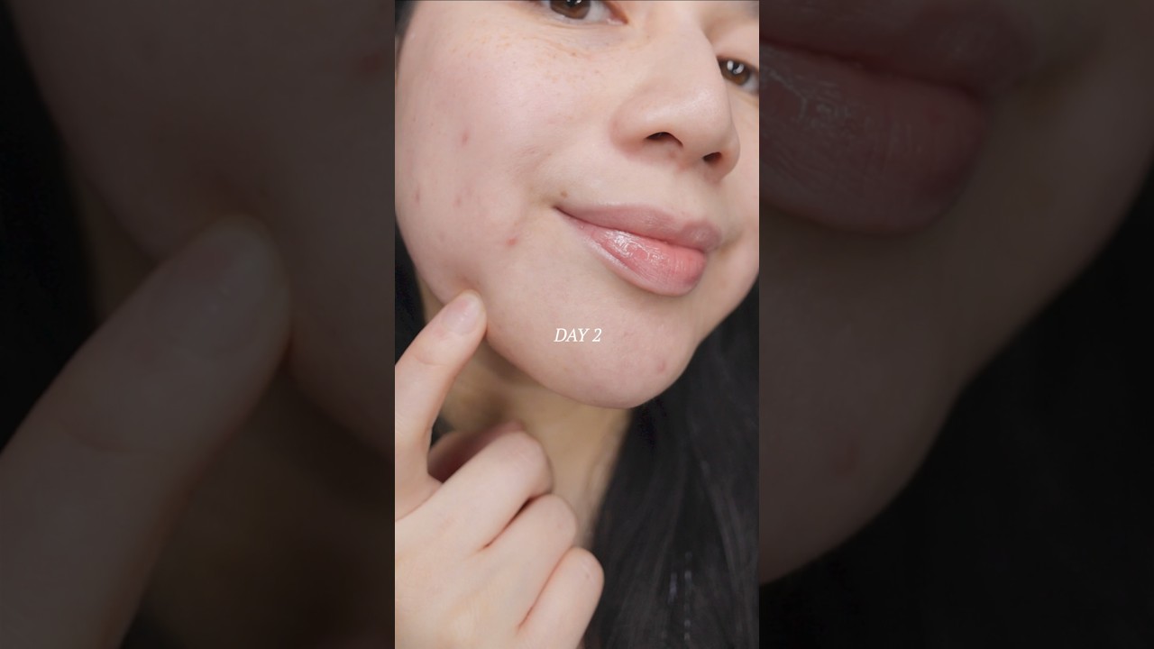 3 day miracle serum for breakouts and blemishes? YES PLEASE! #bringgreen #zincteca