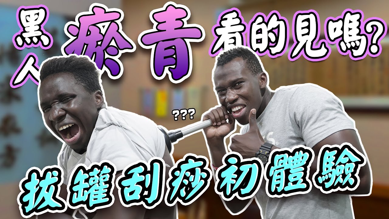 痛到哀哀叫「首次體驗拔罐刮痧」實測黑人瘀青究竟看不看的出來…嘉：ㄟ誰在我屁股那裡？！#嘉男牛魯 @哇洗嘉明 @哇系黑牛