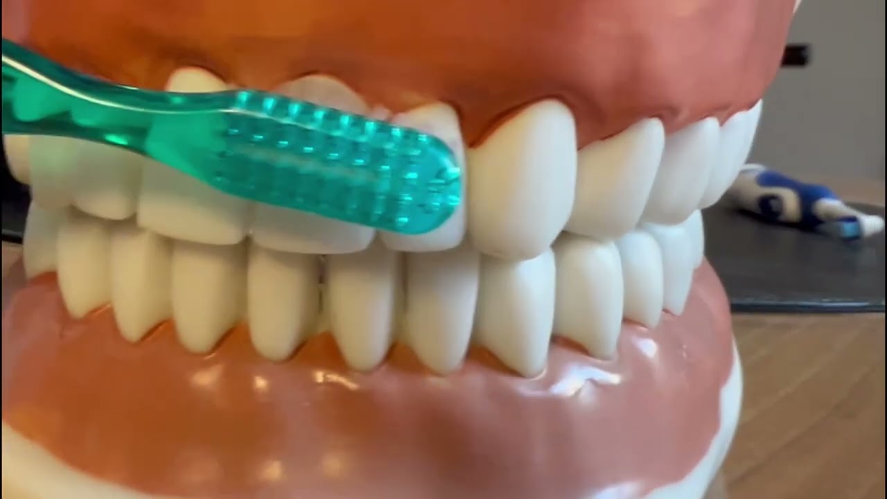 La tecnica corretta per spazzolare i denti durante l'igiene orale con lo spazzolino