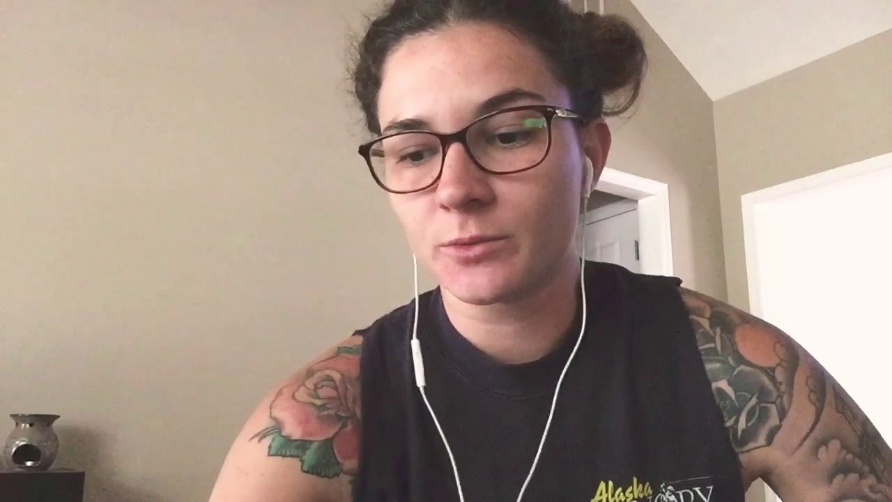 STAPEDECTOMY - SIX MONTHS POST UPDATE