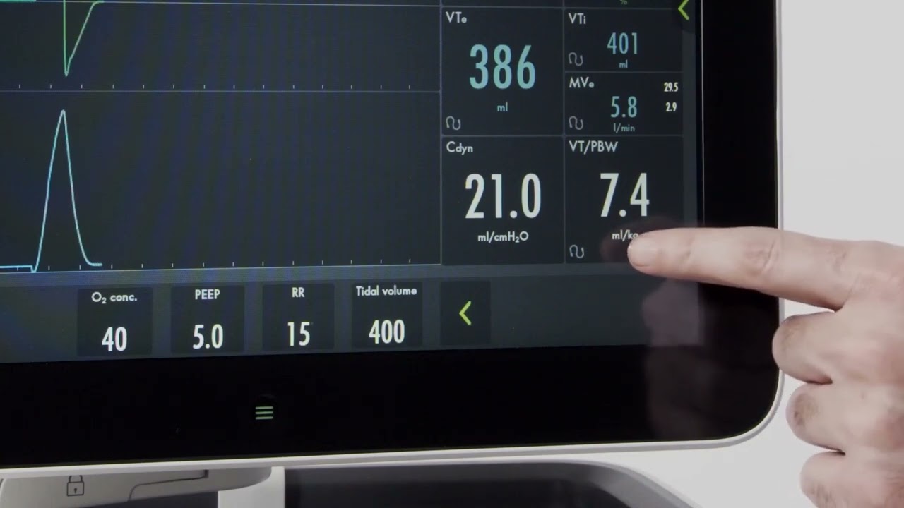 Servo-u ventilator - How to get Predicted Body Weight and VT/PBW on the ventilator