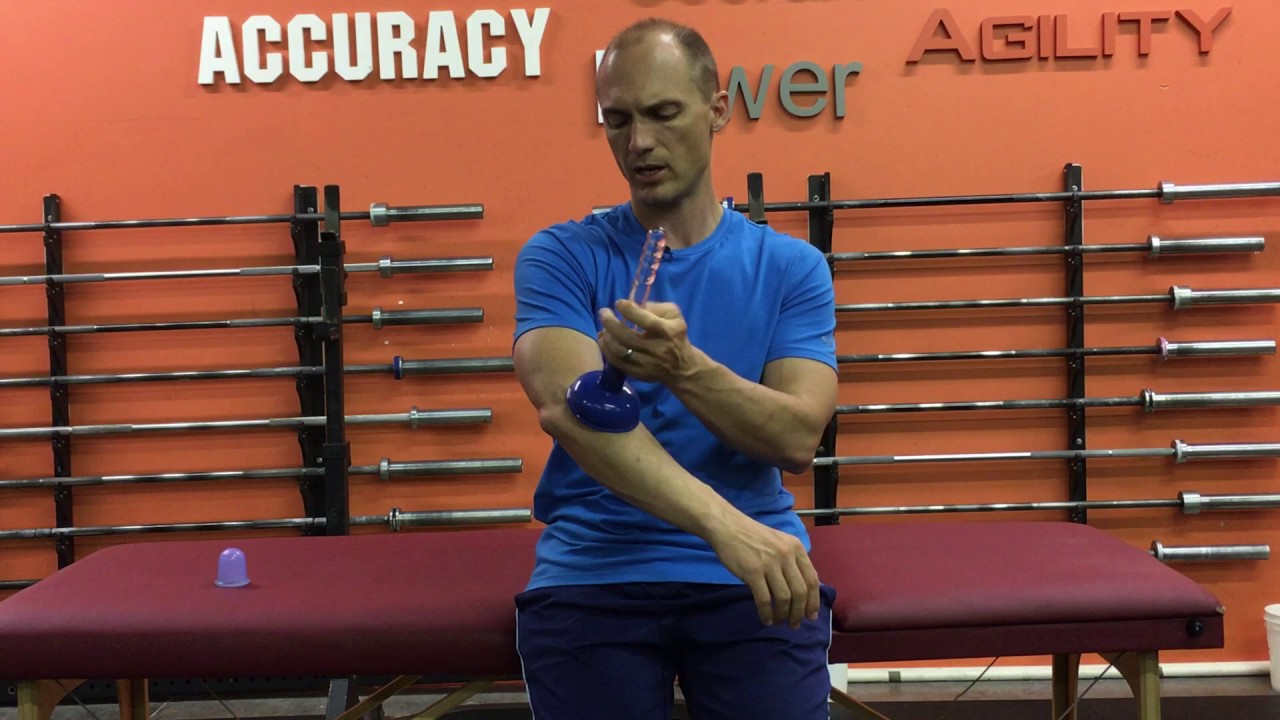 How to Treat Tennis Elbow using Cupping
