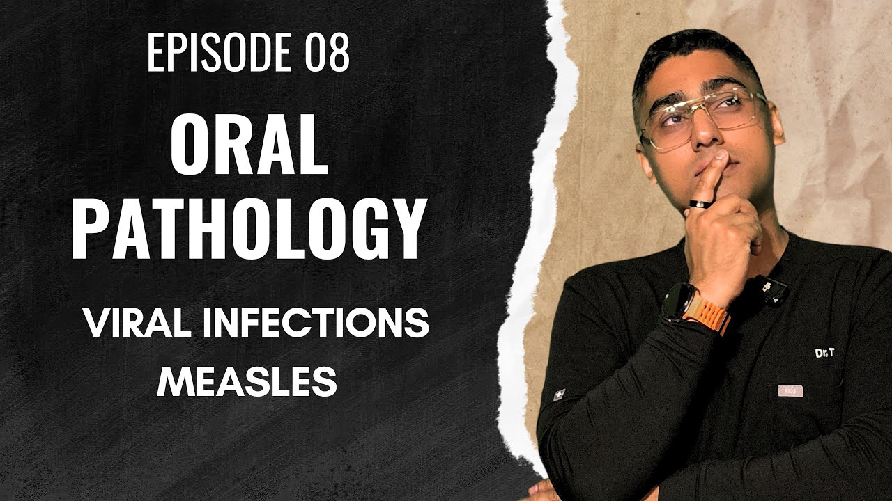 Dental Digest | Oral Pathology | Episode 8 - Measles