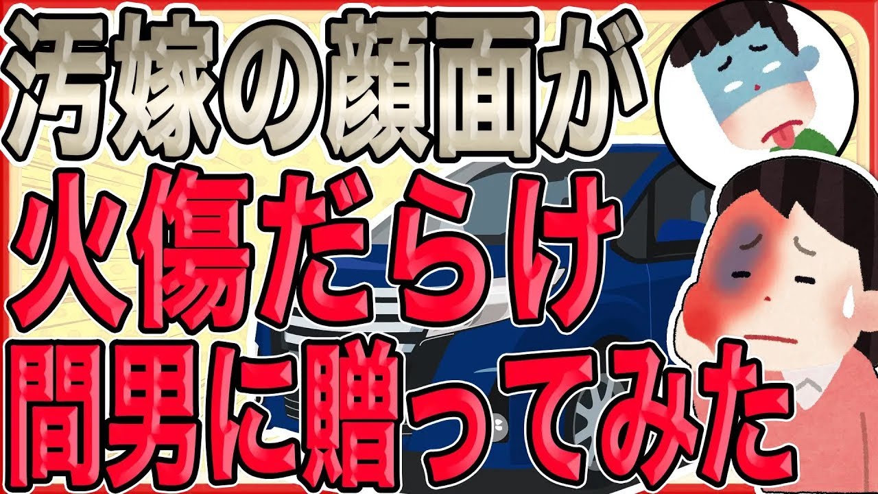 【汚嫁の顔面を火傷だらけにして間男に贈ってみたｯｯ!!!】間男が「彼女は異形だから関係を続けたくない」と本音を漏らしたので、俺は「抱け」と唆す…【2ch 修羅場】【ゆっくりスレ解説】