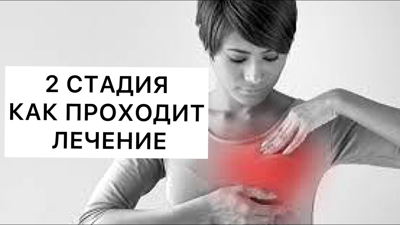 РАК ГРУДИ 2 СТАДИЯ: ОПЕРАЦИЯ, ХИМИОТЕРАПИЯ, ОБЛУЧЕНИЕ.СИМПТОМЫ РАКА