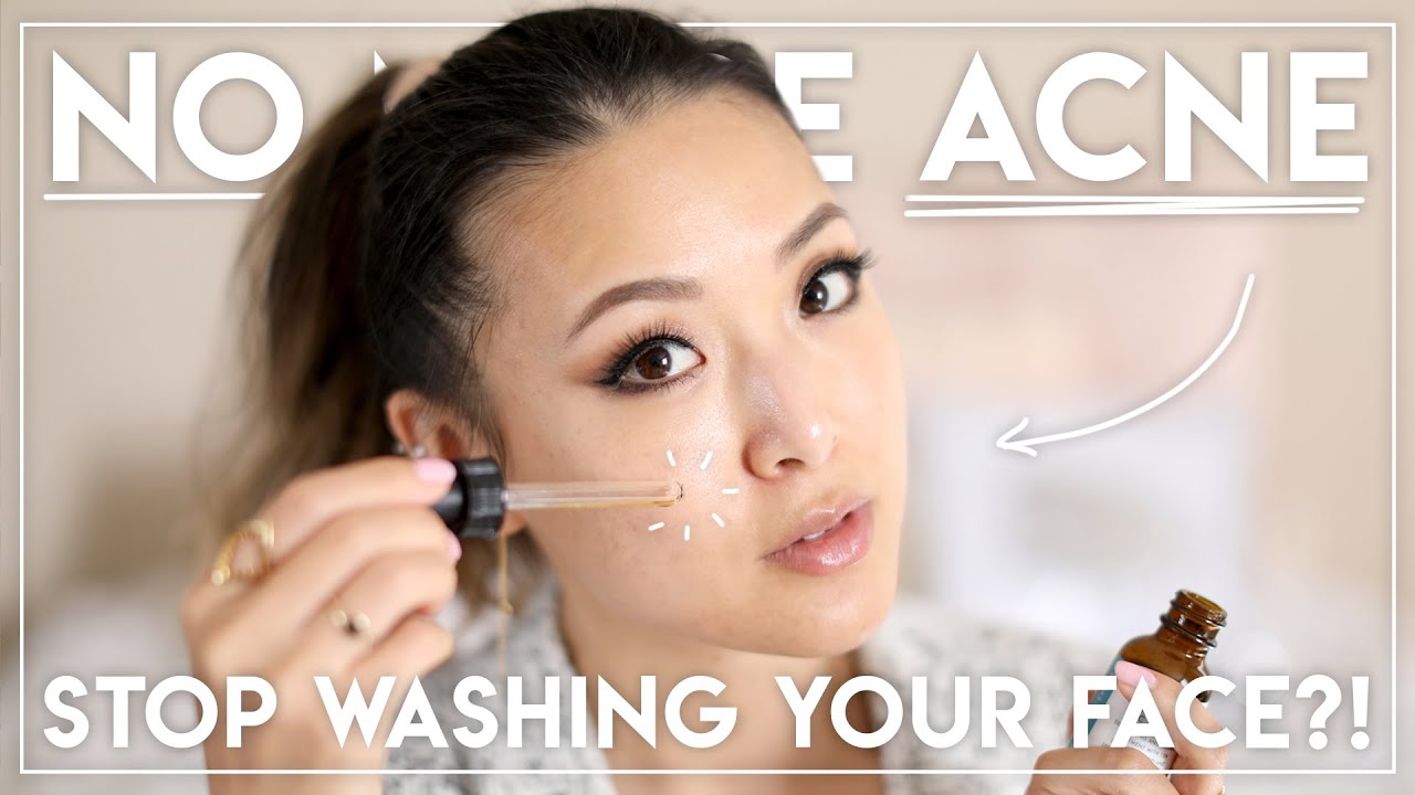 HOW I GOT RID OF MY ACNE (Stopped washing my face?!)