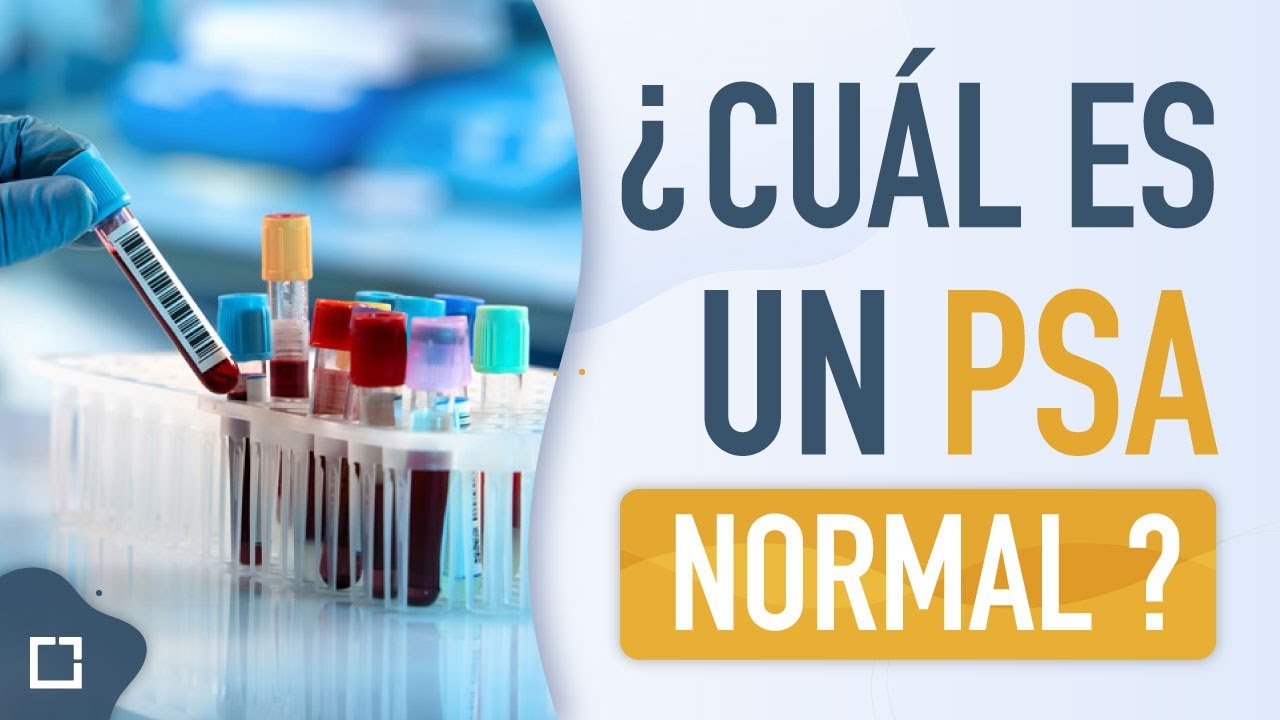 Pr&oacute;stata inflamada o grande &iquest;cual es un PSA NORMAL?