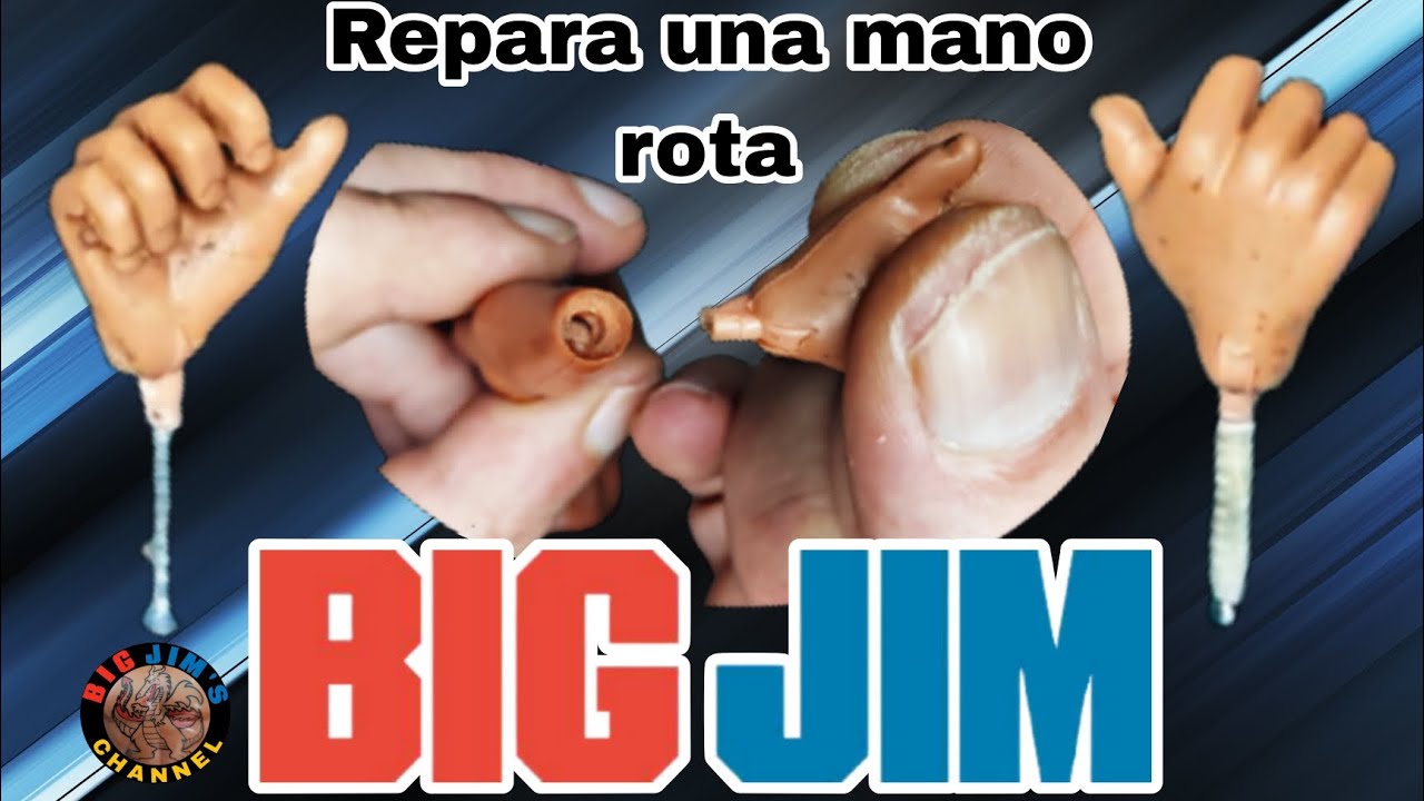 Big Jim repara una mano rota