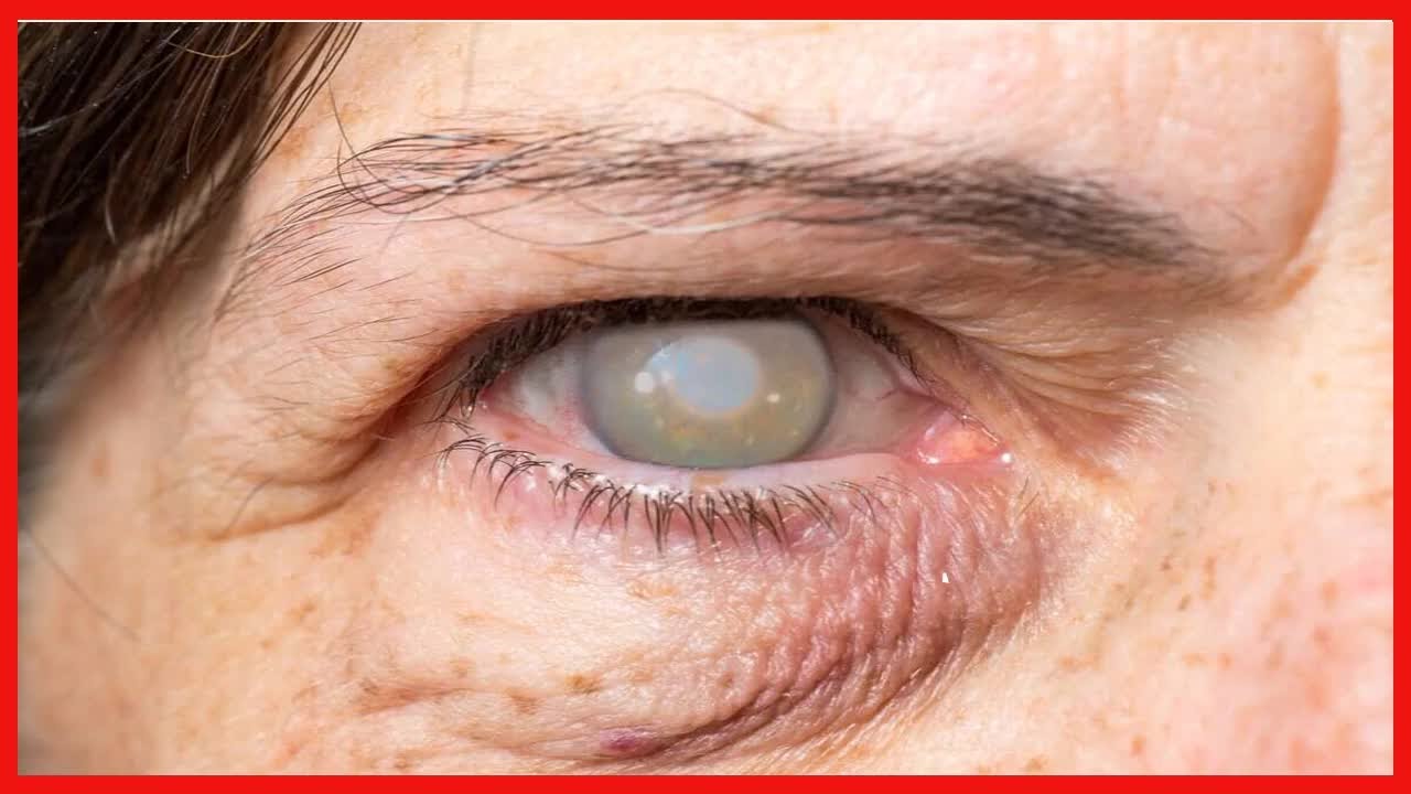 Causes et sympt&ocirc;mes de la perte de la vue