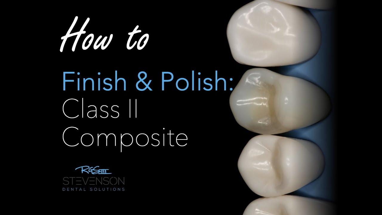 How to Finish and Polish a Class II Composite