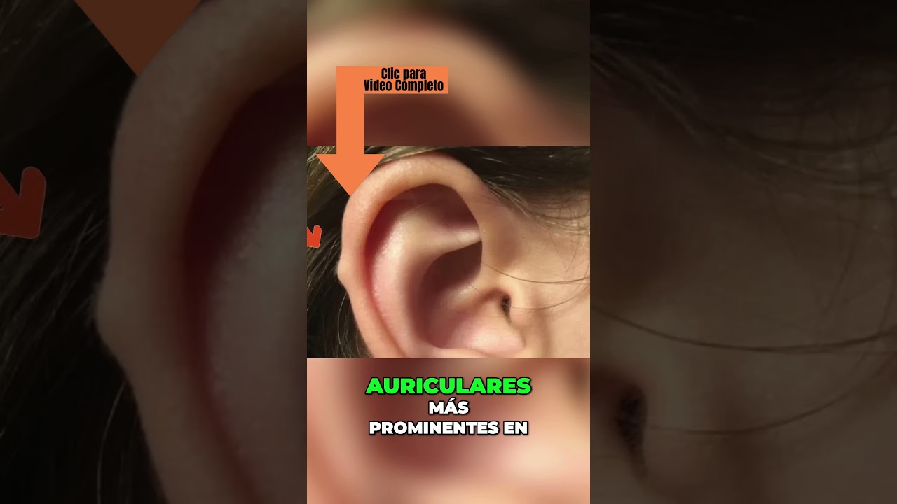 👂 &iquest;Tus OREJAS esconden un SECRETO sobre tu pasado? &iexcl;La ciencia lo revela! 🧬REVELAN DE D&Oacute;NDE VIENES