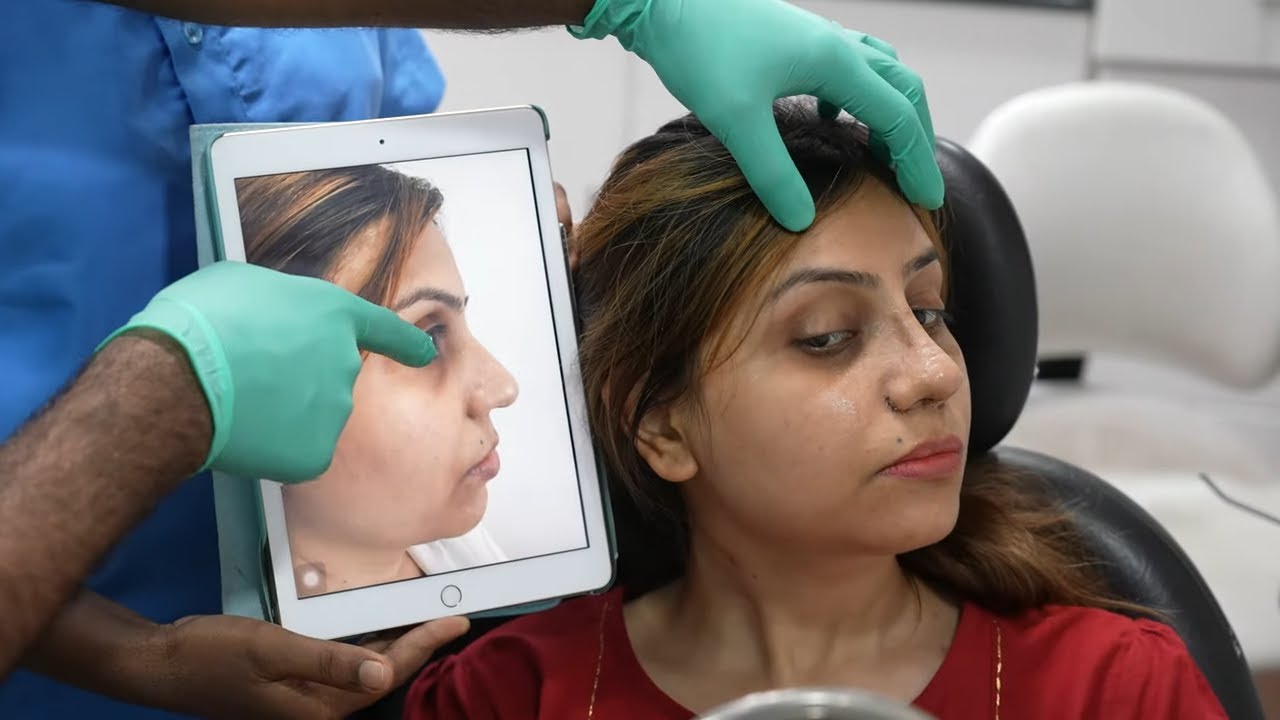Removing a Nasal Splint on the 7th Day After Rhinoplasty