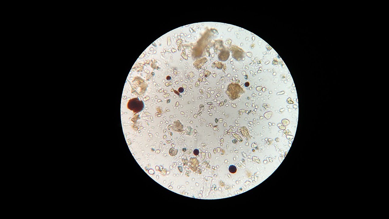 💩🔬Czy badanie ogólne kału wykrywa pasożyty i... jak się wącha kał w laboratorium?