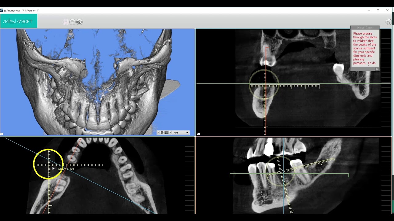 MSOFT Tutorial: Uploading DICOM (Part 1)