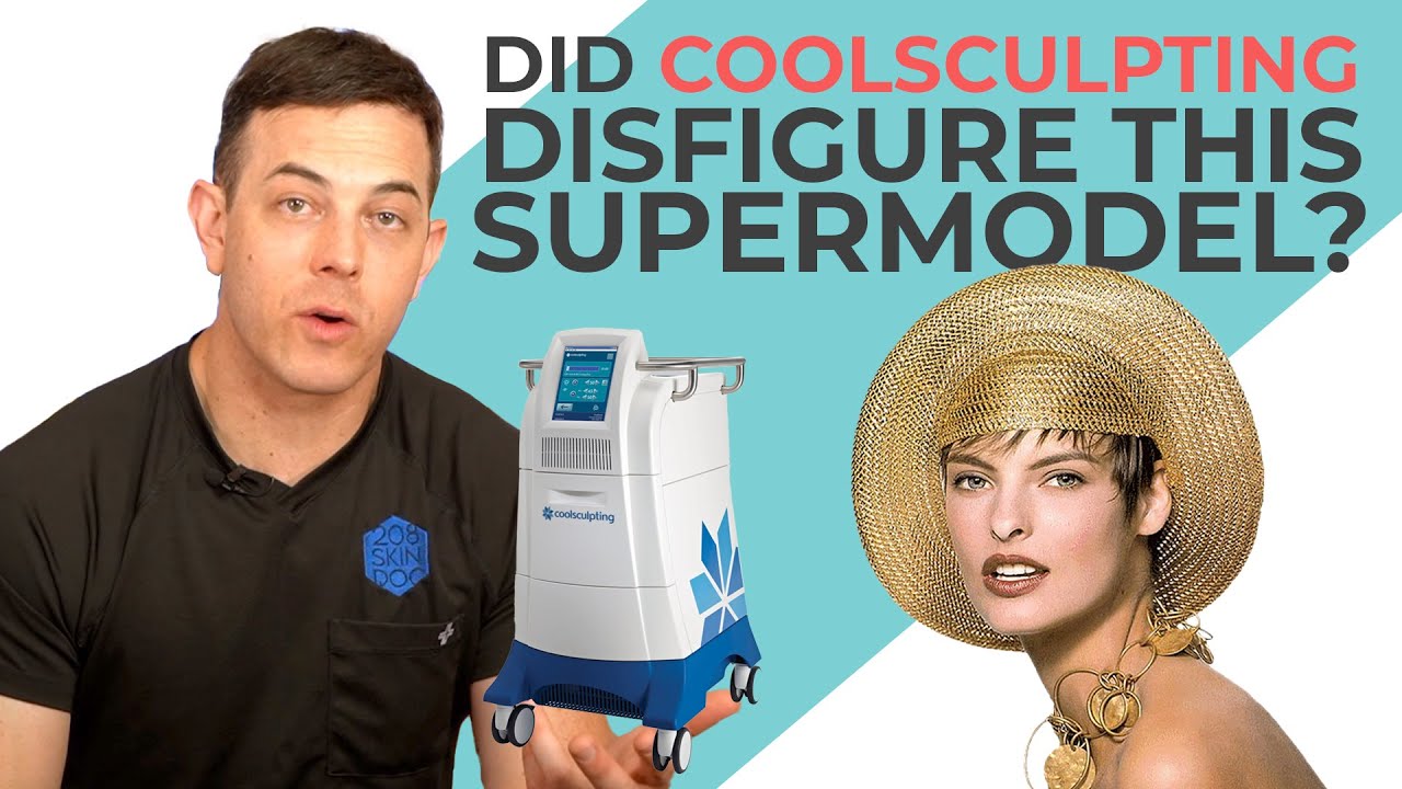 Did CoolSculpting Disfigure Linda Evangelista? | 208SkinDoc