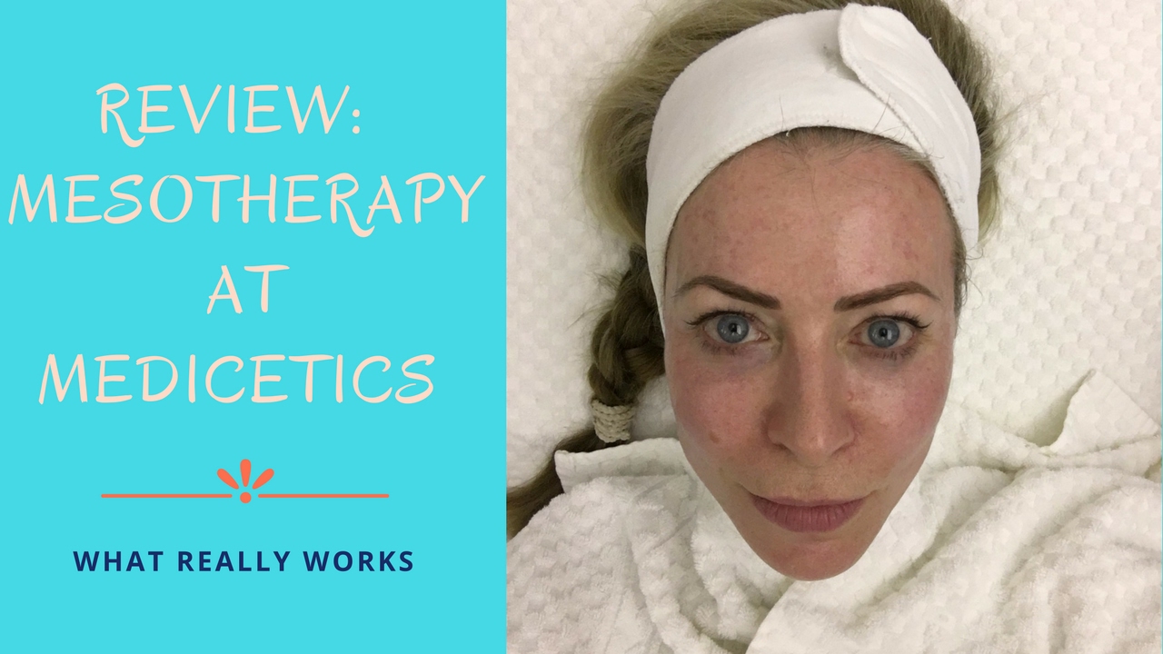Review of Mesotherapy treatment at Medicetics clinic
