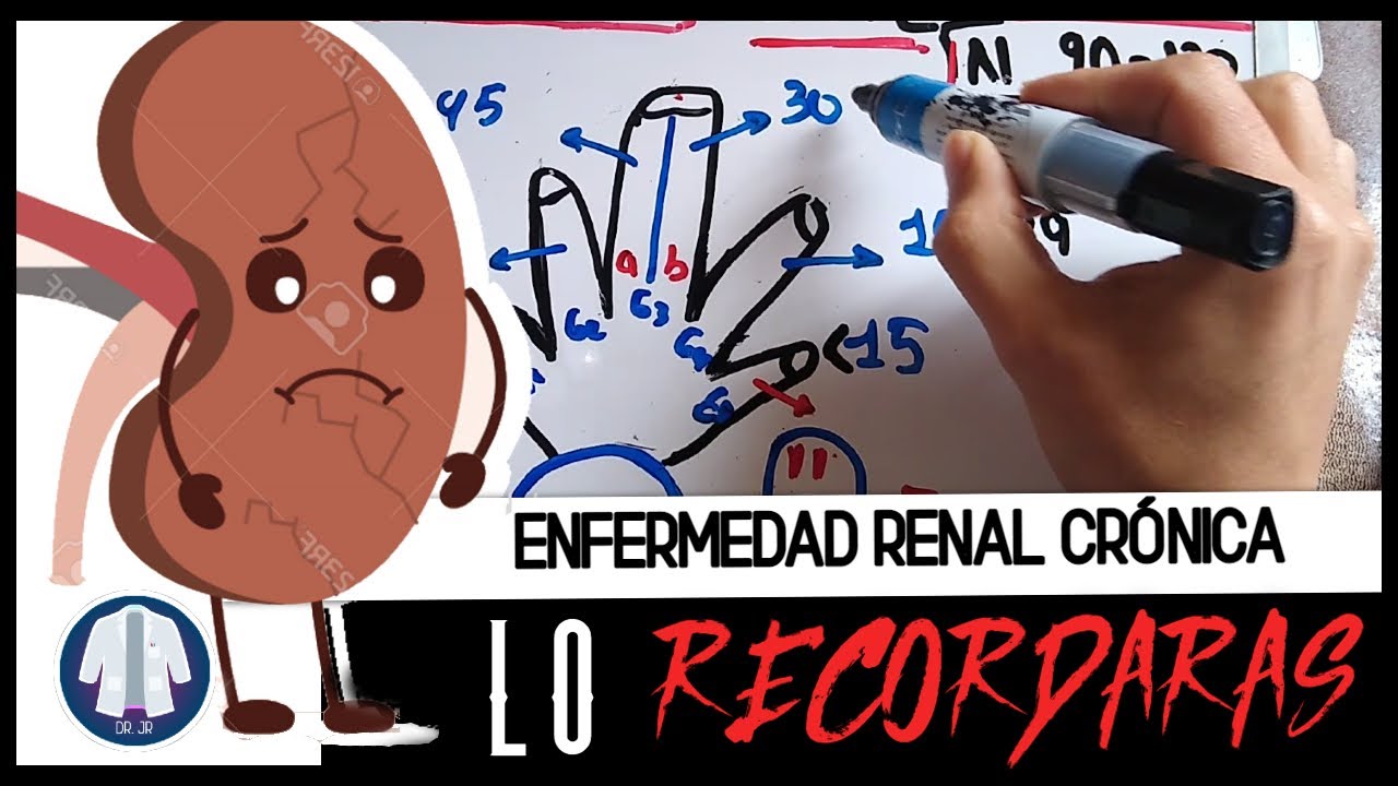 KDIGO. ¿CÓMO RECORDARLO? Clasificación de enfermedad renal crónica. Explicado Dr. JR