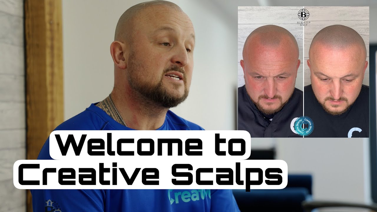 Что такое микропигментация кожи головы? | Добро пожаловать в Creative Scalps
