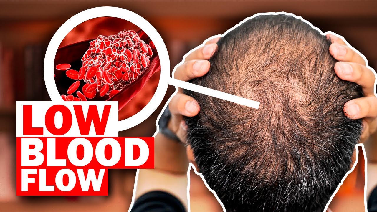 The root cause of hair loss (and why it's been hidden!)
