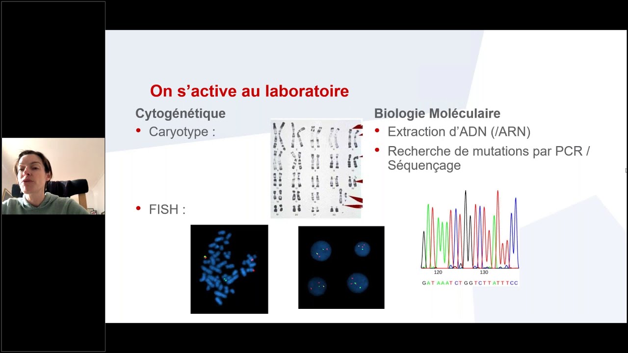 Prise en charge de la leucémie lymphoblastique aiguë | Conférence sur la leucémie