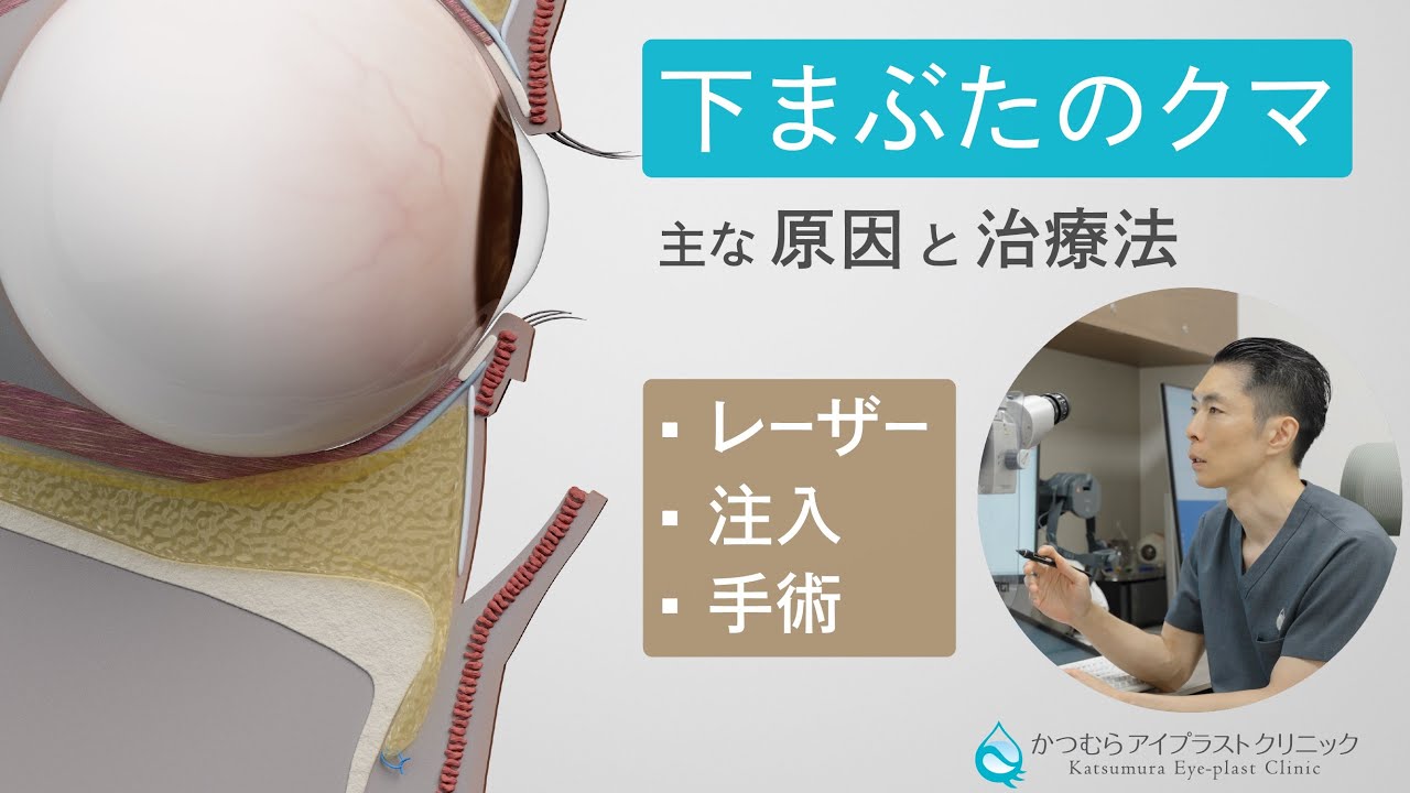下まぶたの(たるみ)クマとは？　原因と治療方法