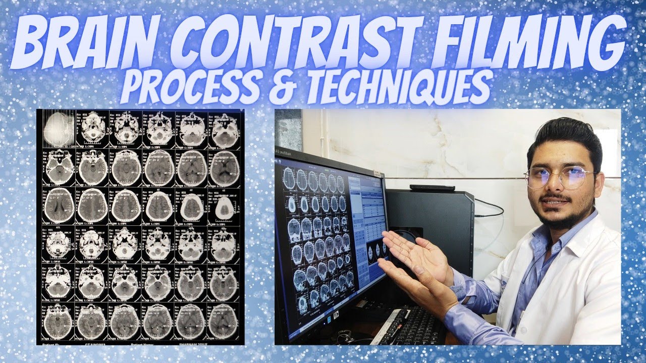 CECT Brain filming process & techniques| How to make filming of Brain contrast.