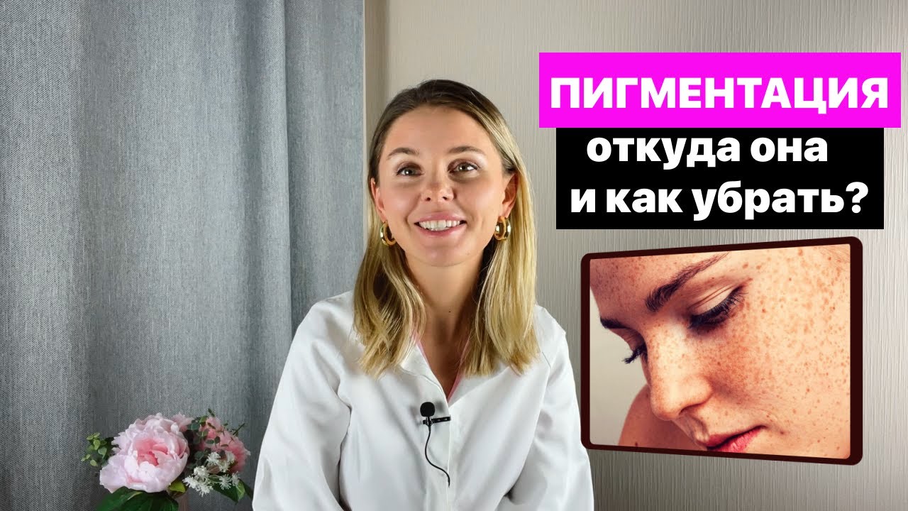 Пигментация: откуда она и как убрать?