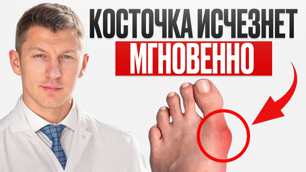 ТОЛЬКО это простое упражнение уберет косточку на ноге НАВСЕГДА!/ Как убрать вальгус?