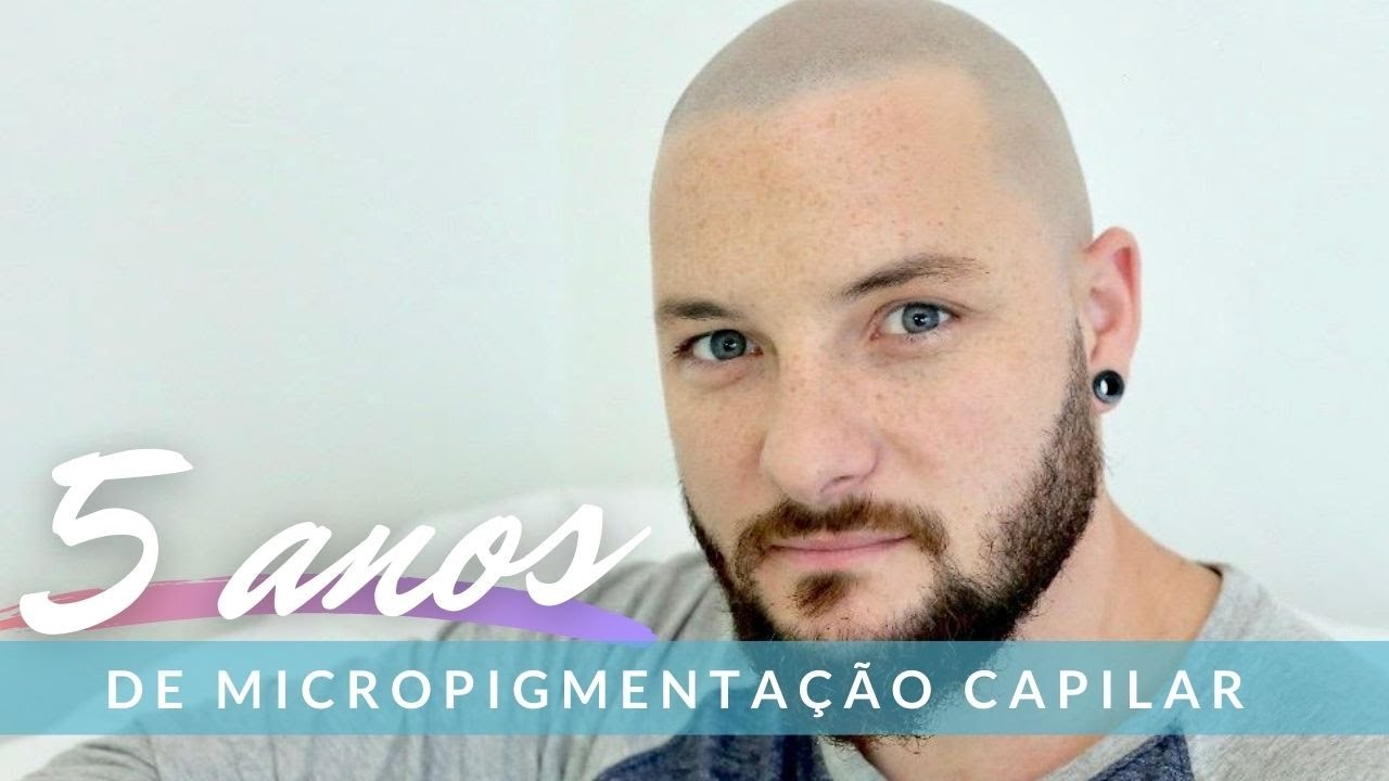 5 anos de #Micropigmentação Capilar