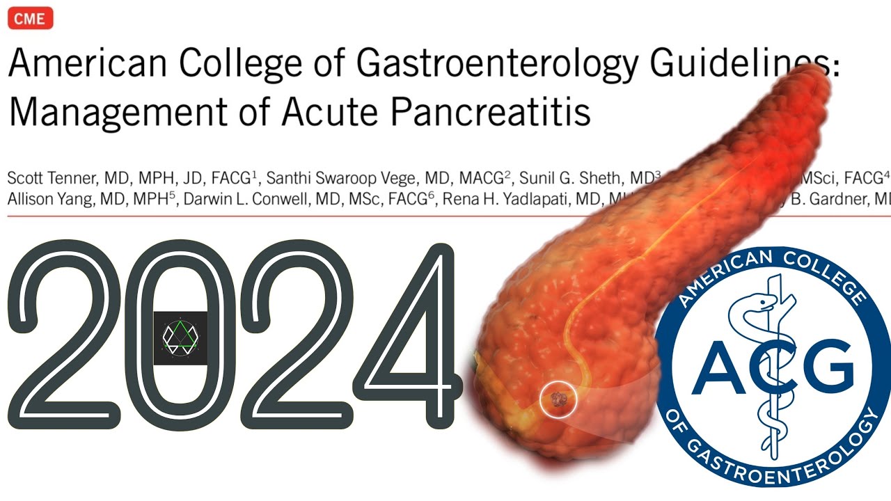 PANCREATITIS AGUDA. Guía 2024