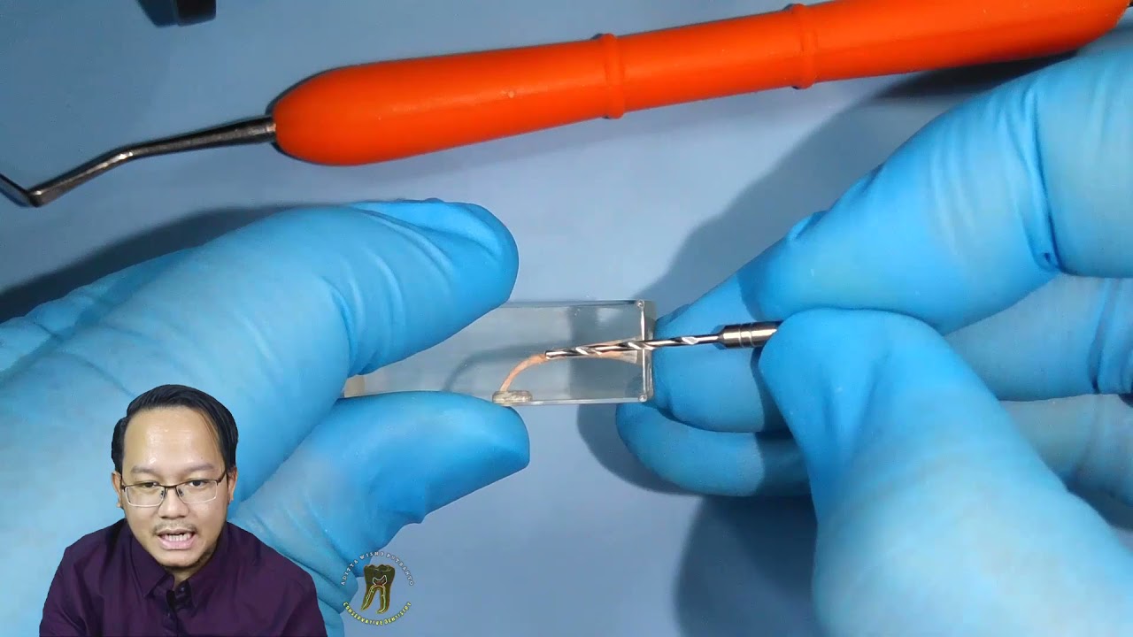 FiberPost (Webinar & Live-Demo) - Acara Ladogi 2021 Sponsored By Dentalities