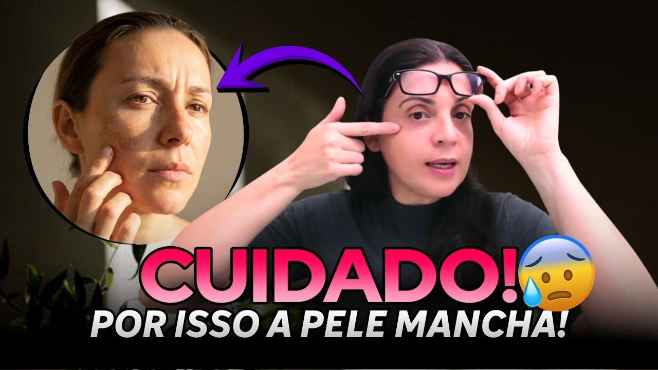 6 fatores comuns que podem estar escurecendo suas manchas sem você perceber