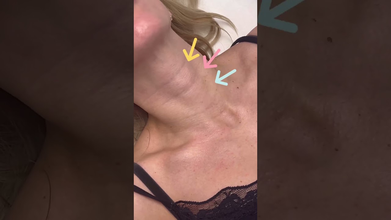 🚨&iquest;Arrugas en el #cuello?💉Alucina con el resultado inmediato del tratamiento &laquo;STOP cuello smartphone&raquo;