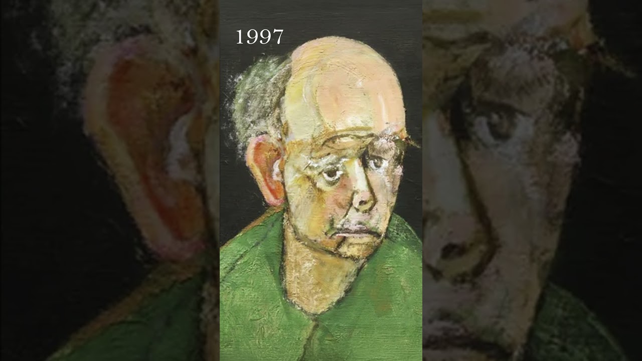 The tragic series of self portraits by patient with Alzheimer's