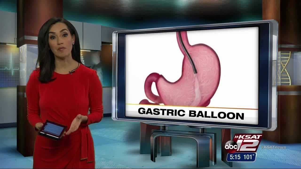 Video: Gastric balloon option for more sizes
