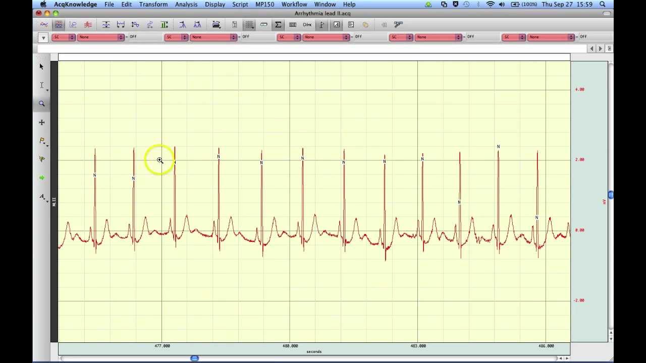 Classify Heartbeats