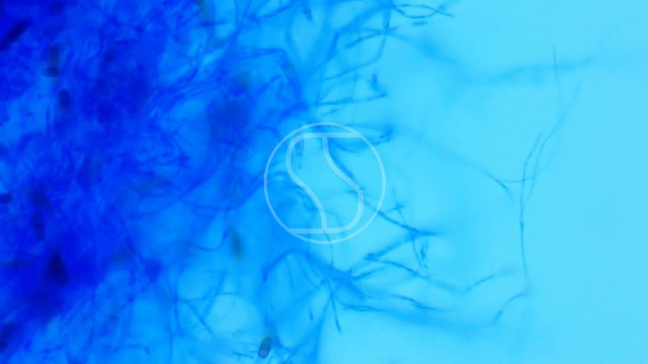 Bipolaris with Lactophenol Cotton Blue Stain, Bright Field and Phase Contras Microscopy