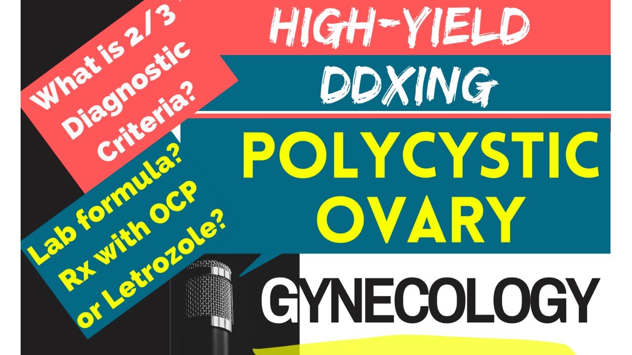 Polycystic Ovarian Syndrome (2023 update): Diagnostic Criteria, workup, Management
