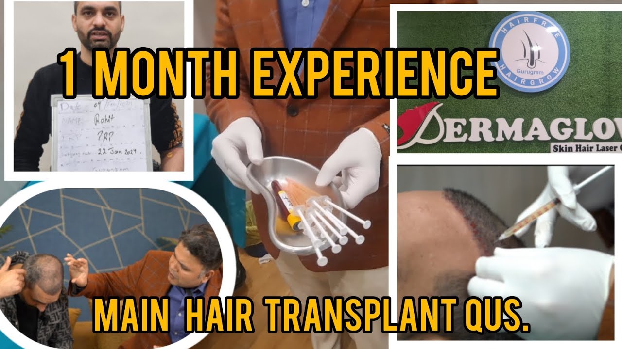 HAIR TRANSPLANT KI VAJHA SE PARESHAN | ITNI MEDICINES | PAINFUL | TRANSPLANT EK GALTI | PRP RESULT |