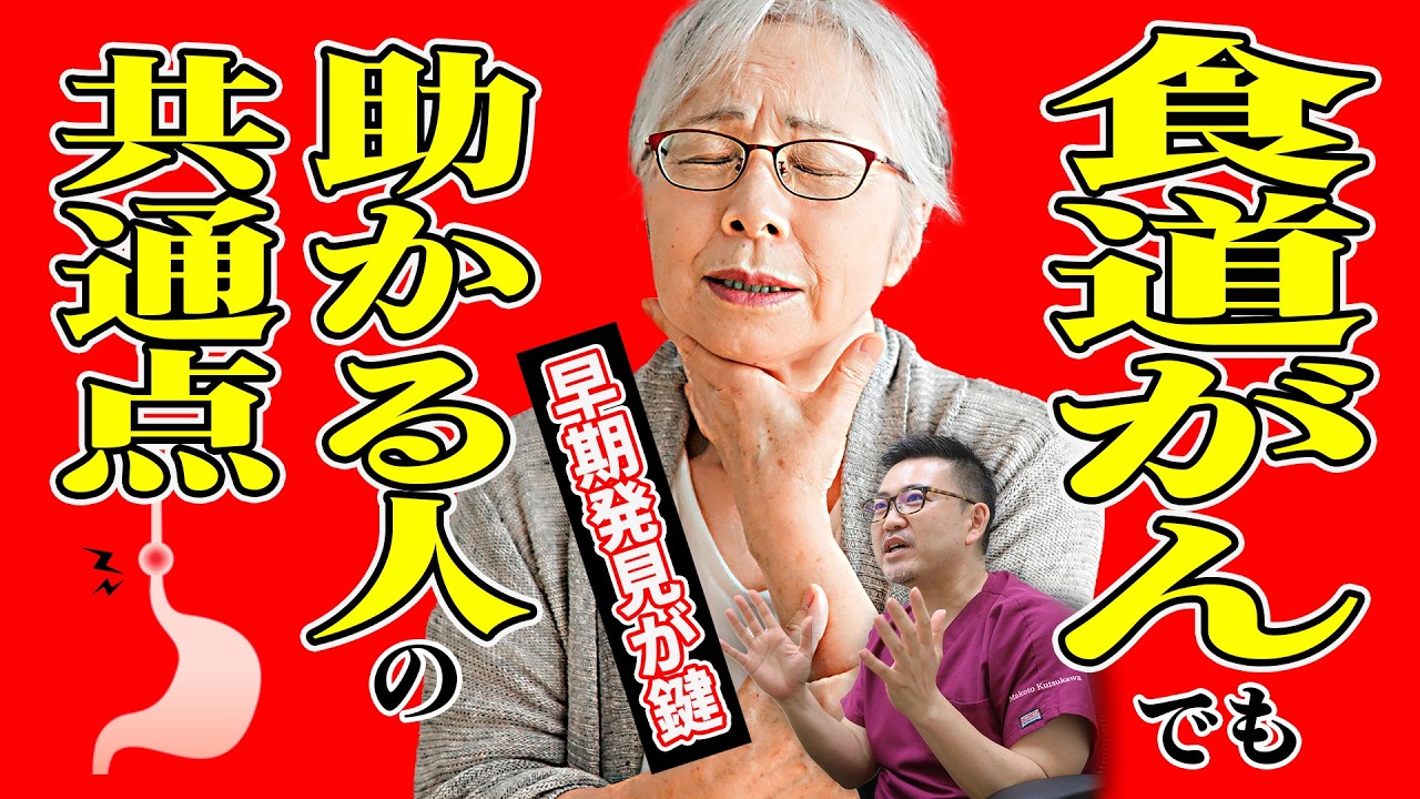 【早期発見がカギ】食道がん・胃がんから助かった人の共通点とは？　なぜ助かった？胃カメラで命を救った人の習慣とは No513